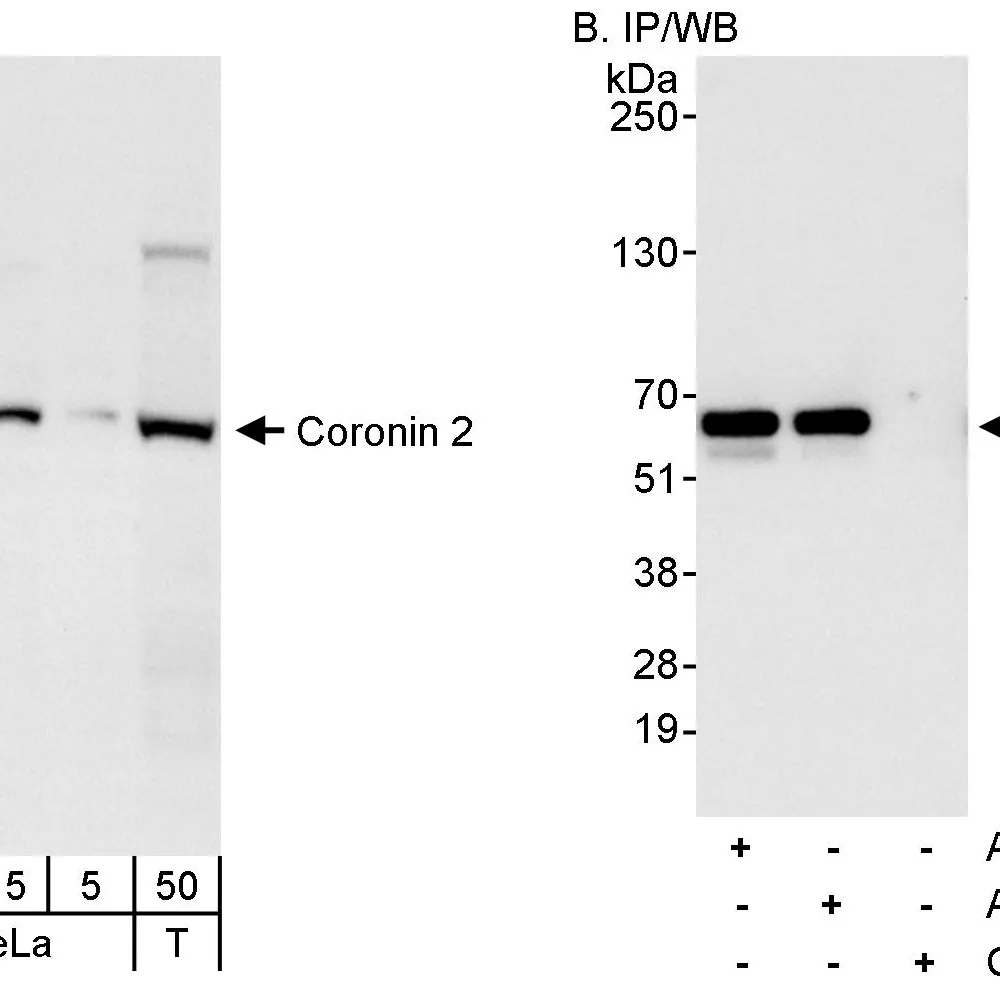 Rabbit anti-Coronin 2 Antibody, Affinity Purified