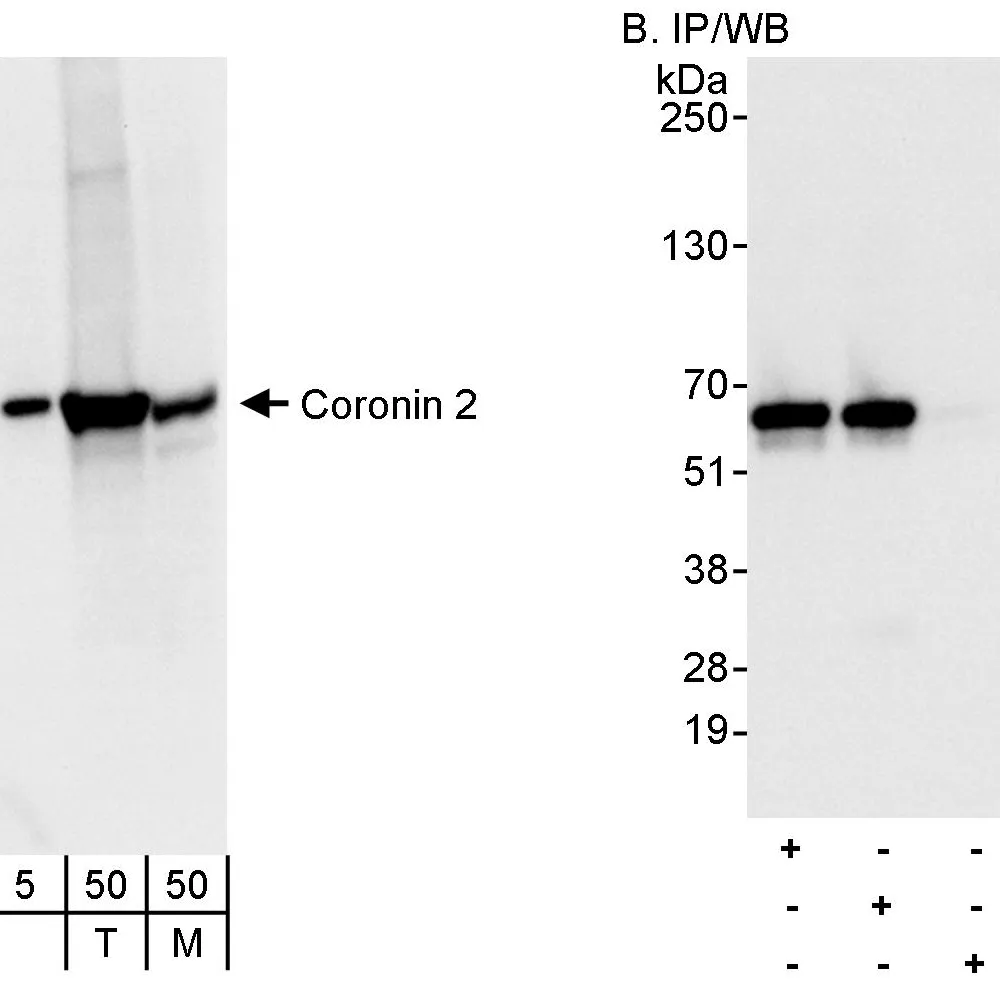 Rabbit anti-Coronin 2 Antibody, Affinity Purified