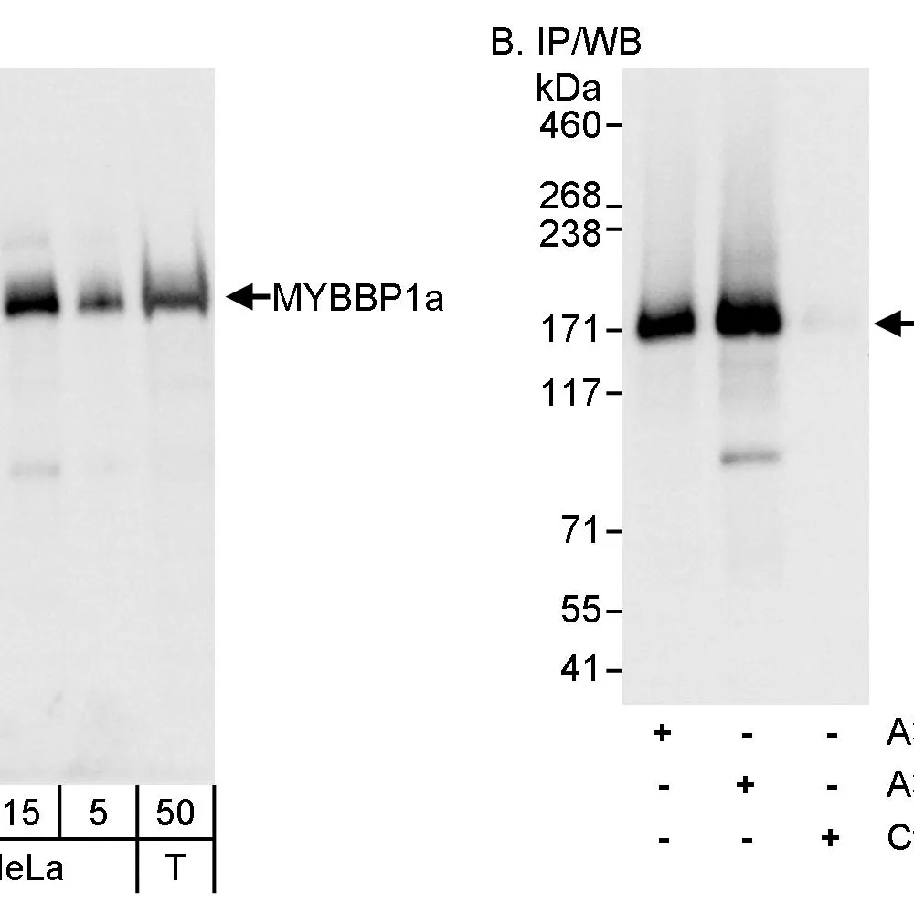 Rabbit anti-MYBBP1A Antibody, Affinity Purified