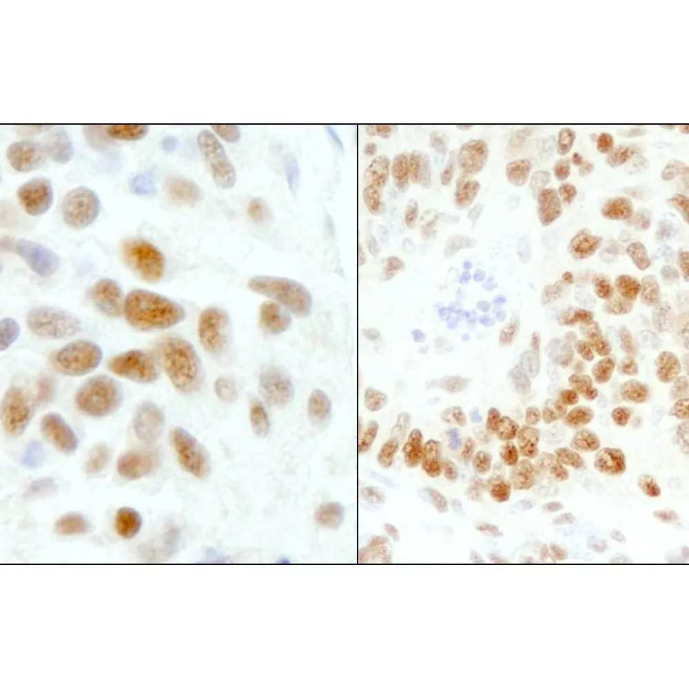 Rabbit anti-GTF2I/TFII-I Antibody, Affinity Purified