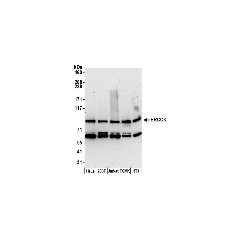 Rabbit anti-ERCC3 Antibody, Affinity Purified