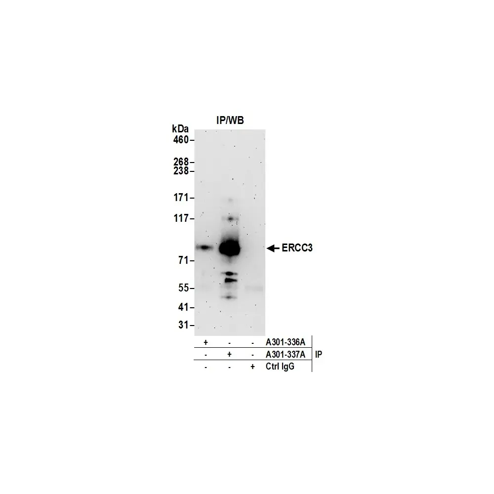 Rabbit anti-ERCC3 Antibody, Affinity Purified