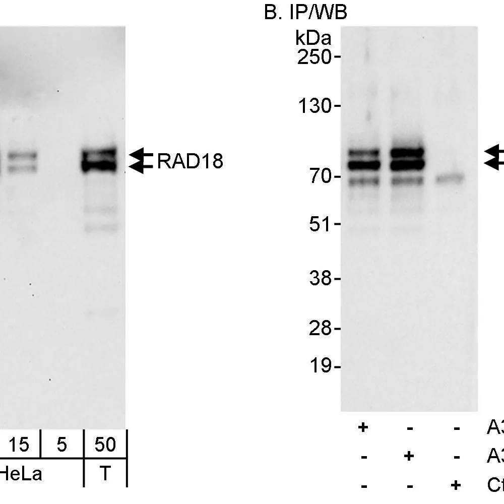 Rabbit anti-Rad18 Antibody, Affinity Purified