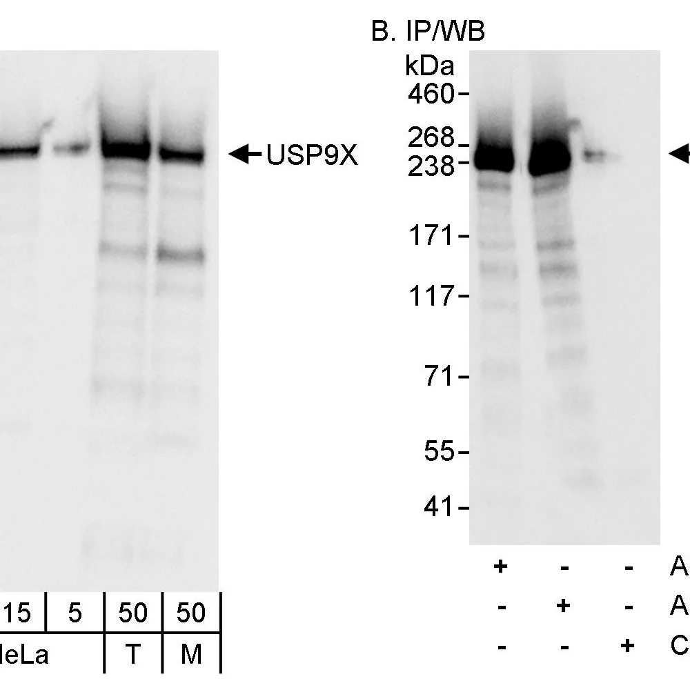 Rabbit anti-USP9X Antibody, Affinity Purified