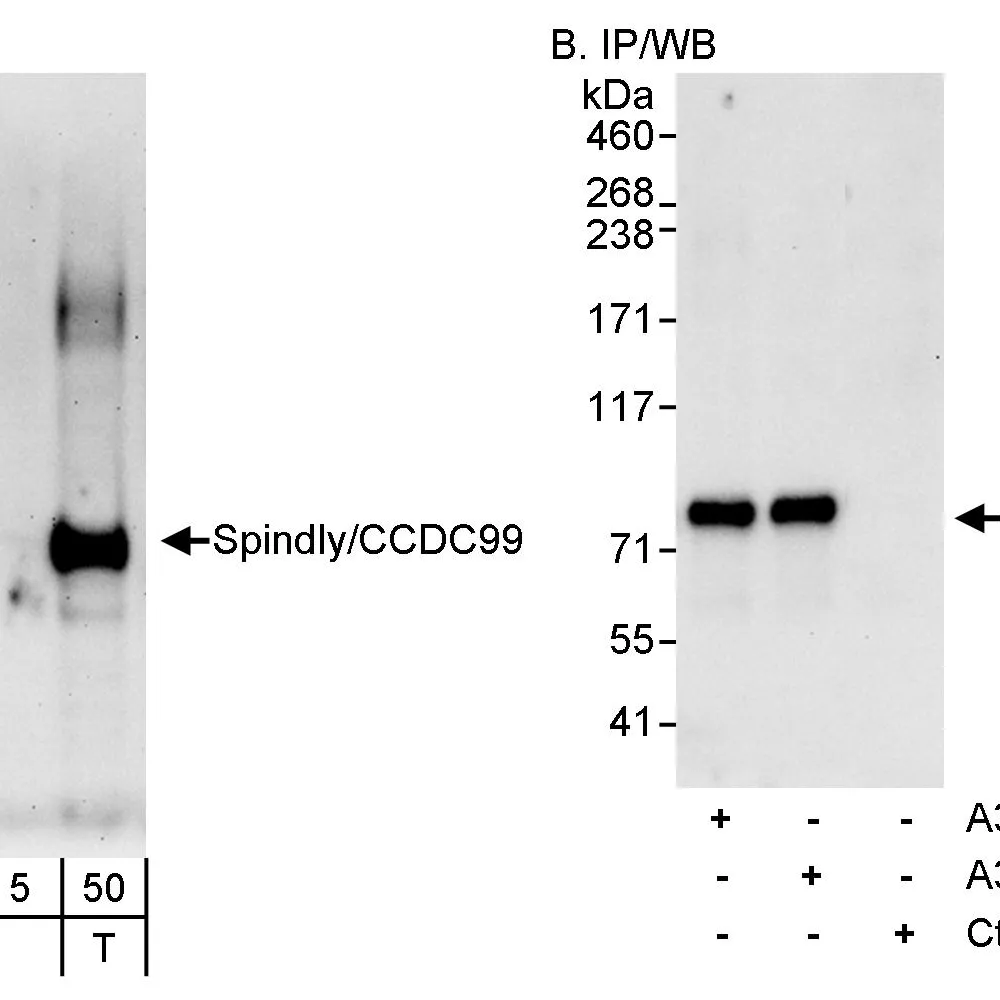 Rabbit anti-SPINDLY/CCDC99 Antibody, Affinity Purified