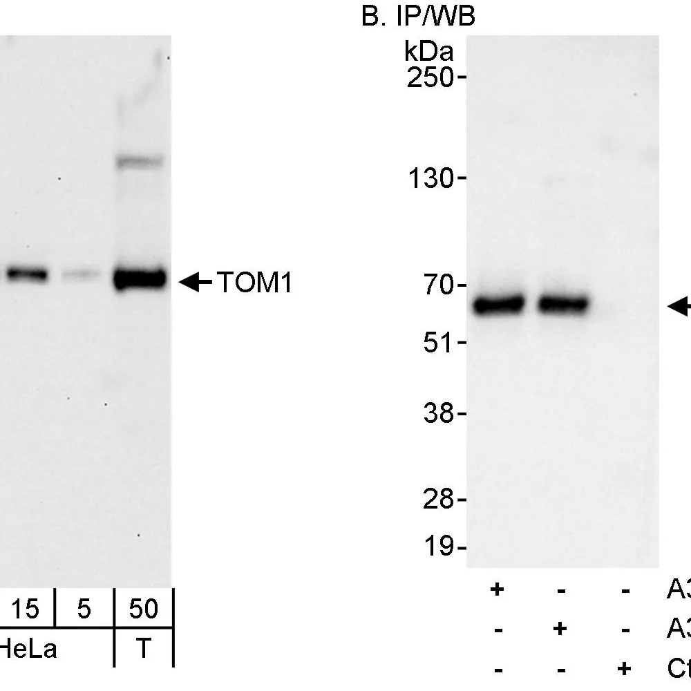 Rabbit anti-TOM1 Antibody, Affinity Purified