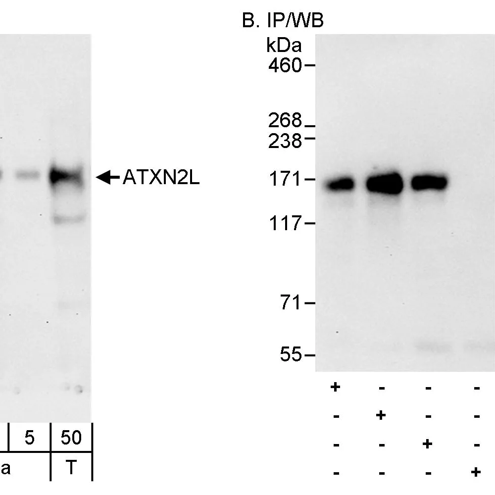 Rabbit anti-ATXN2L Antibody, Affinity Purified
