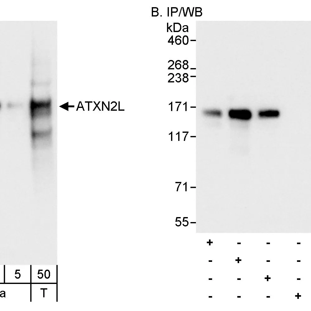 Rabbit anti-ATXN2L Antibody, Affinity Purified
