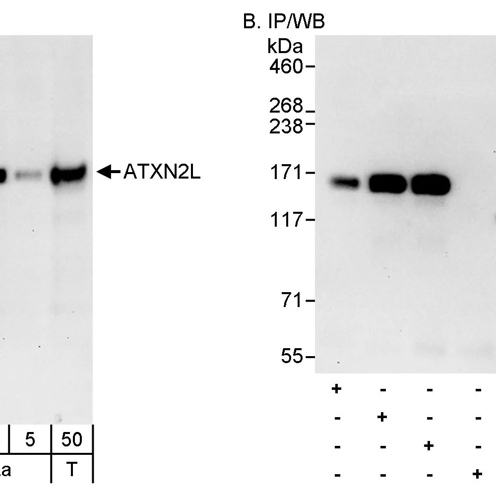 Rabbit anti-ATXN2L Antibody, Affinity Purified