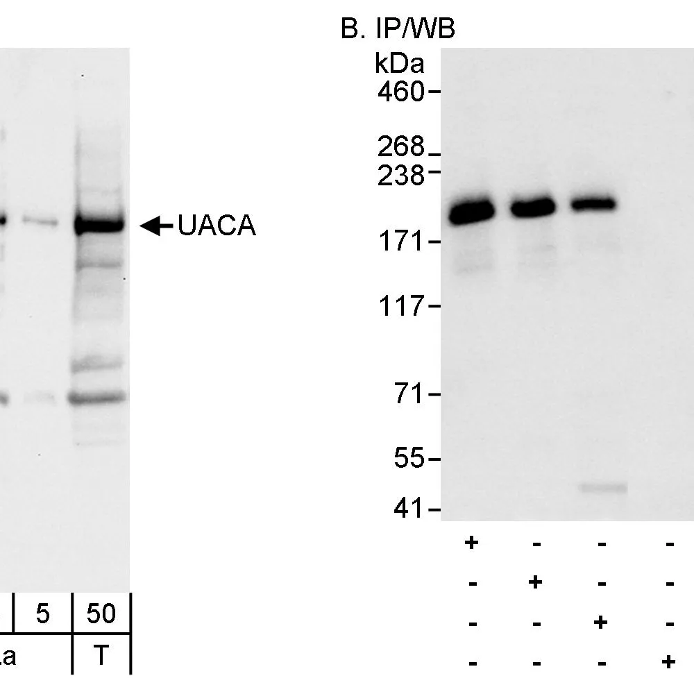 Rabbit anti-UACA Antibody, Affinity Purified