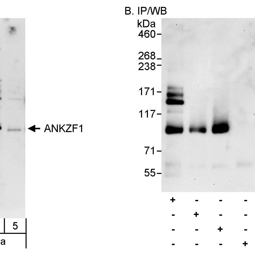 Rabbit anti-ANKZF1 Antibody, Affinity Purified