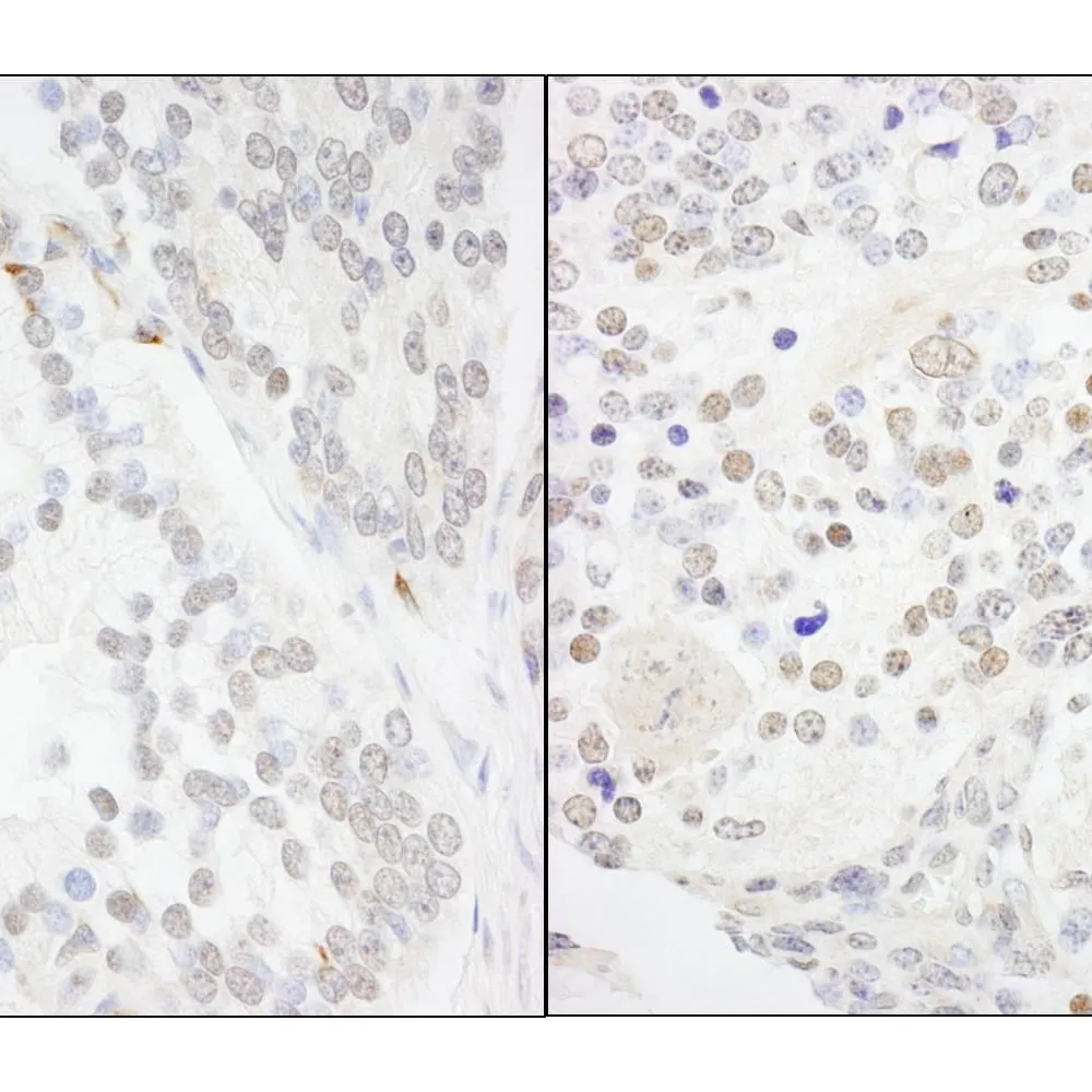 Rabbit anti-ANKS3 Antibody, Affinity Purified