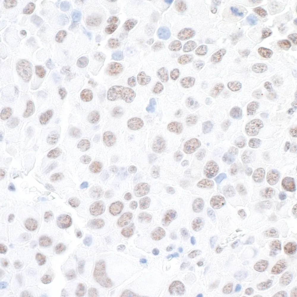 Rabbit anti-BAF53A Antibody, Affinity Purified