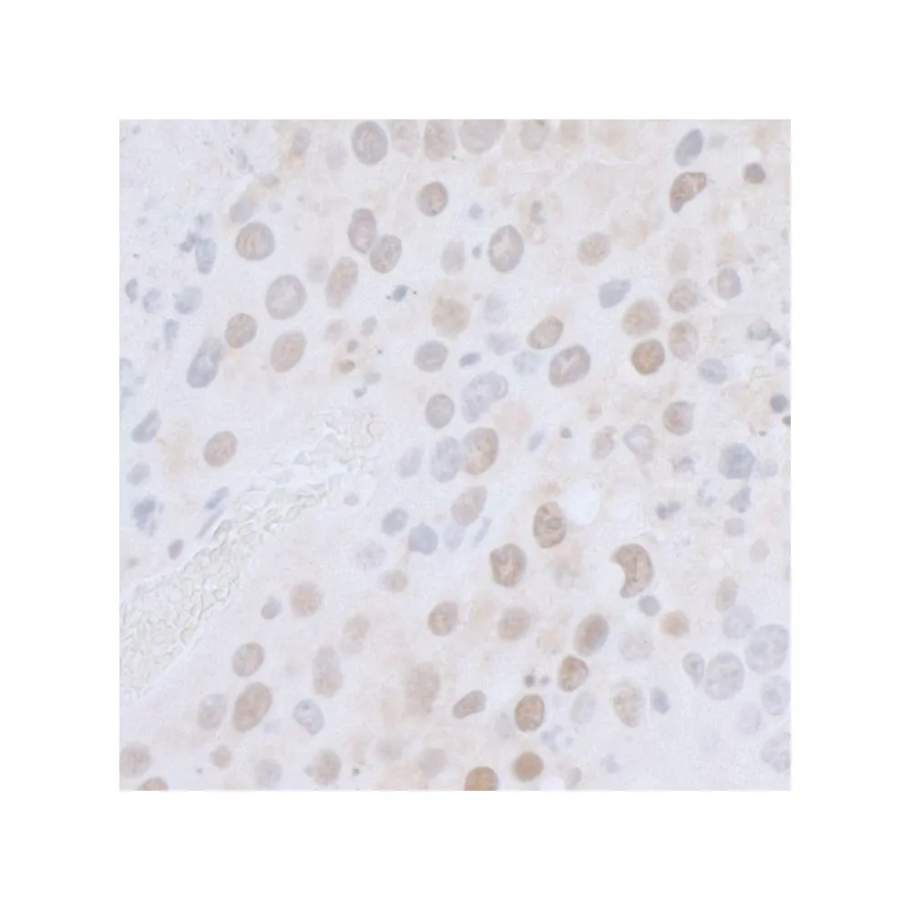 Rabbit anti-CTR9 Antibody, Affinity Purified