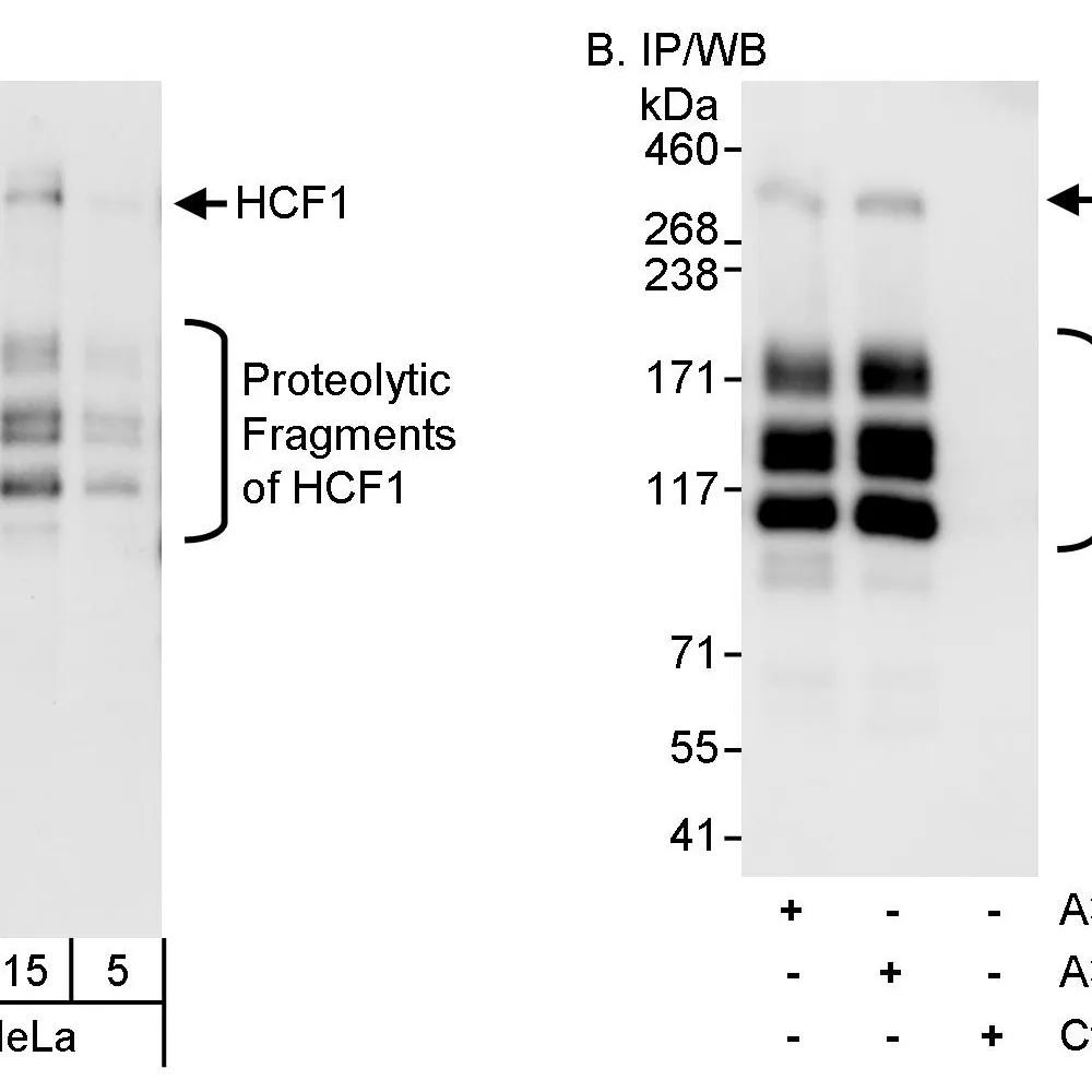 Rabbit anti-HCF1 Antibody, Affinity Purified