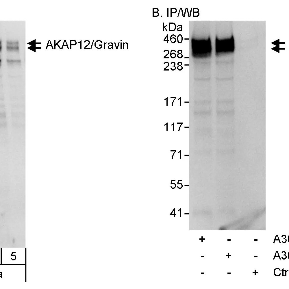 Rabbit anti-AKAP12/Gravin Antibody, Affinity Purified