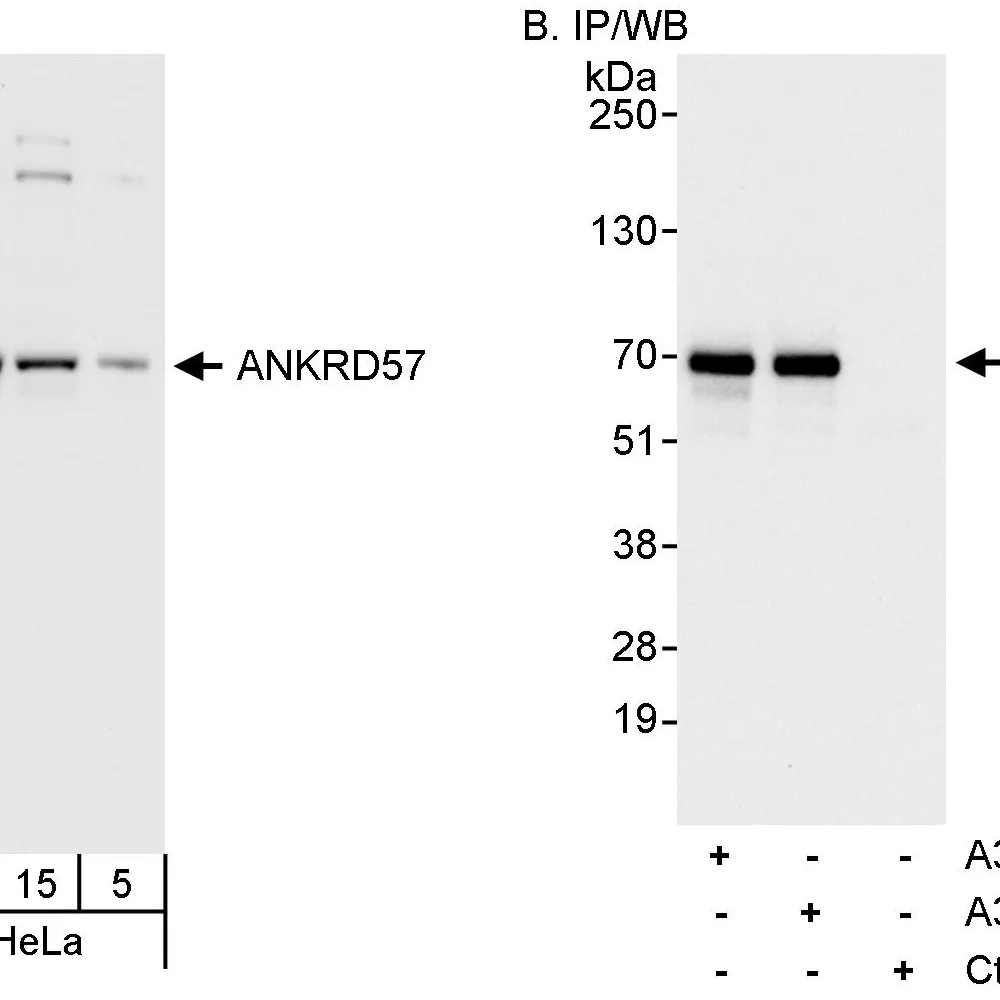 Rabbit anti-ANKRD57 Antibody, Affinity Purified