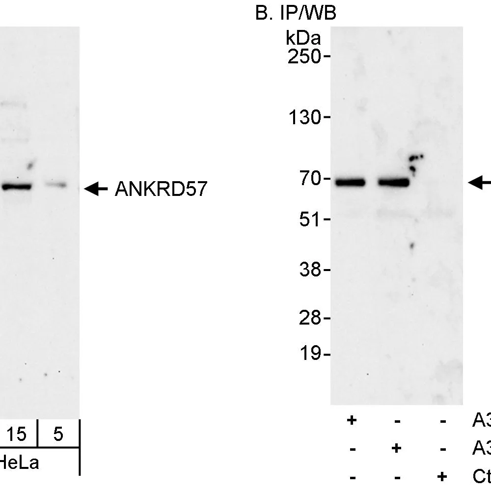 Rabbit anti-ANKRD57 Antibody, Affinity Purified