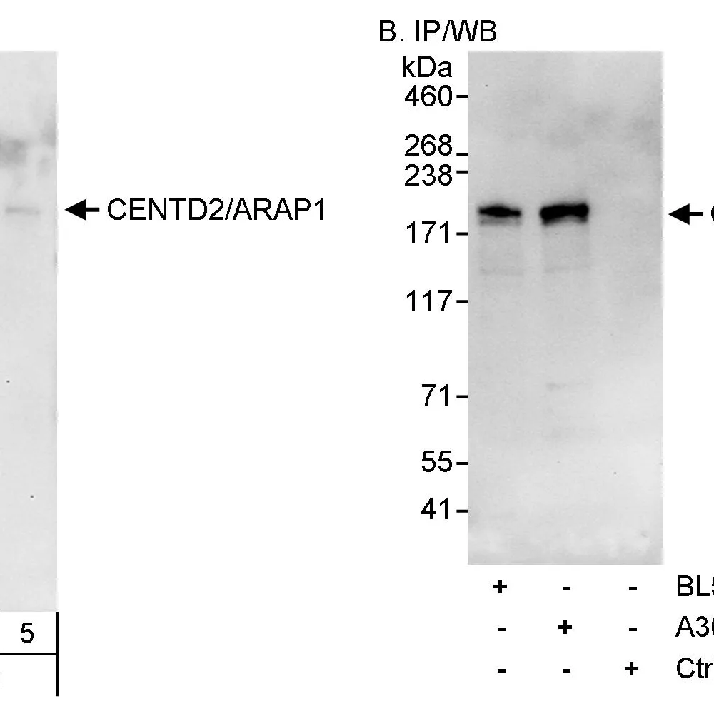 Rabbit anti-CENTD2/ARAP1 Antibody, Affinity Purified