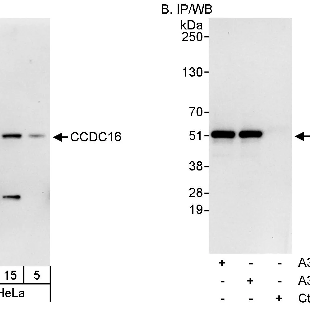 Rabbit anti-CCDC16 Antibody, Affinity Purified