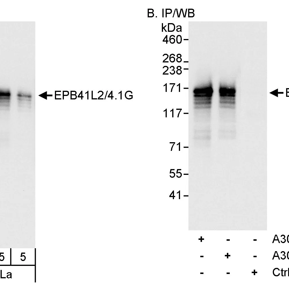 Rabbit anti-EPB41L2/4.1G Antibody, Affinity Purified