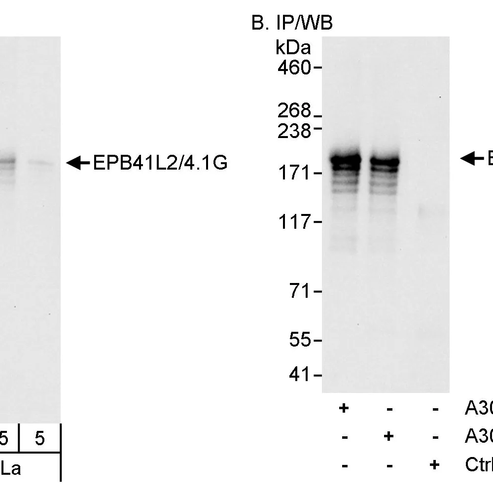 Rabbit anti-EPB41L2/4.1G Antibody, Affinity Purified
