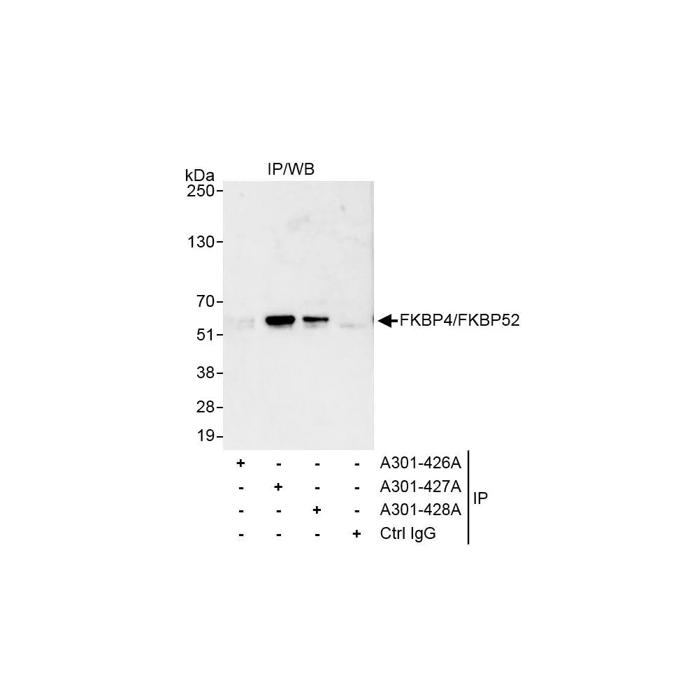 Rabbit anti-FKBP4/FKBP52 Antibody, Affinity Purified