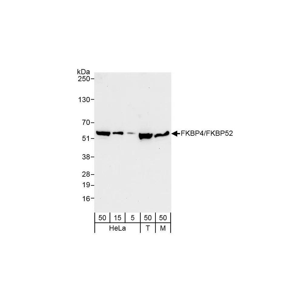 Rabbit anti-FKBP4/FKBP52 Antibody, Affinity Purified