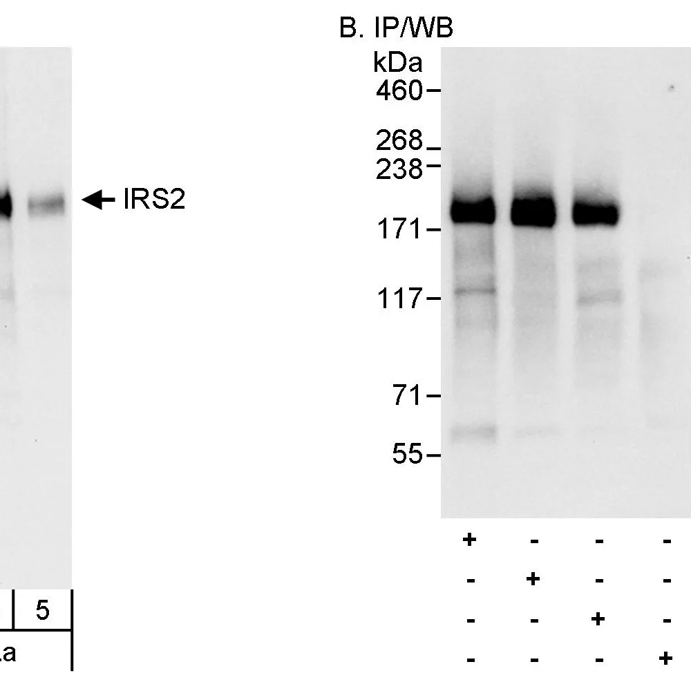 Rabbit anti-IRS2 Antibody, Affinity Purified