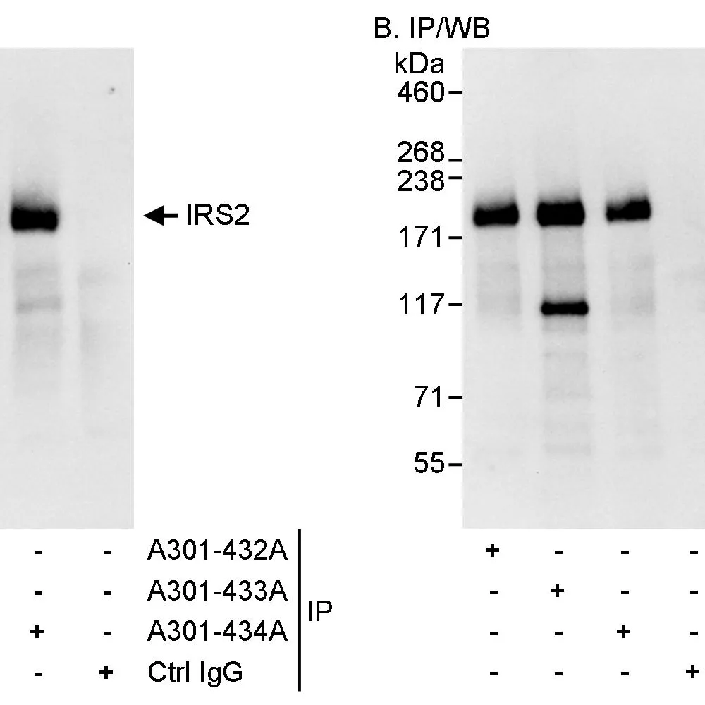 Rabbit anti-IRS2 Antibody, Affinity Purified