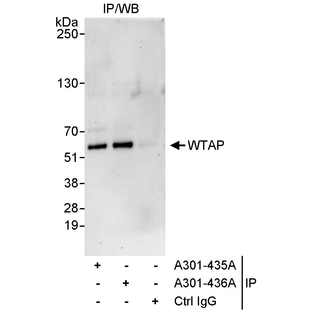 Rabbit anti-WTAP Antibody, Affinity Purified