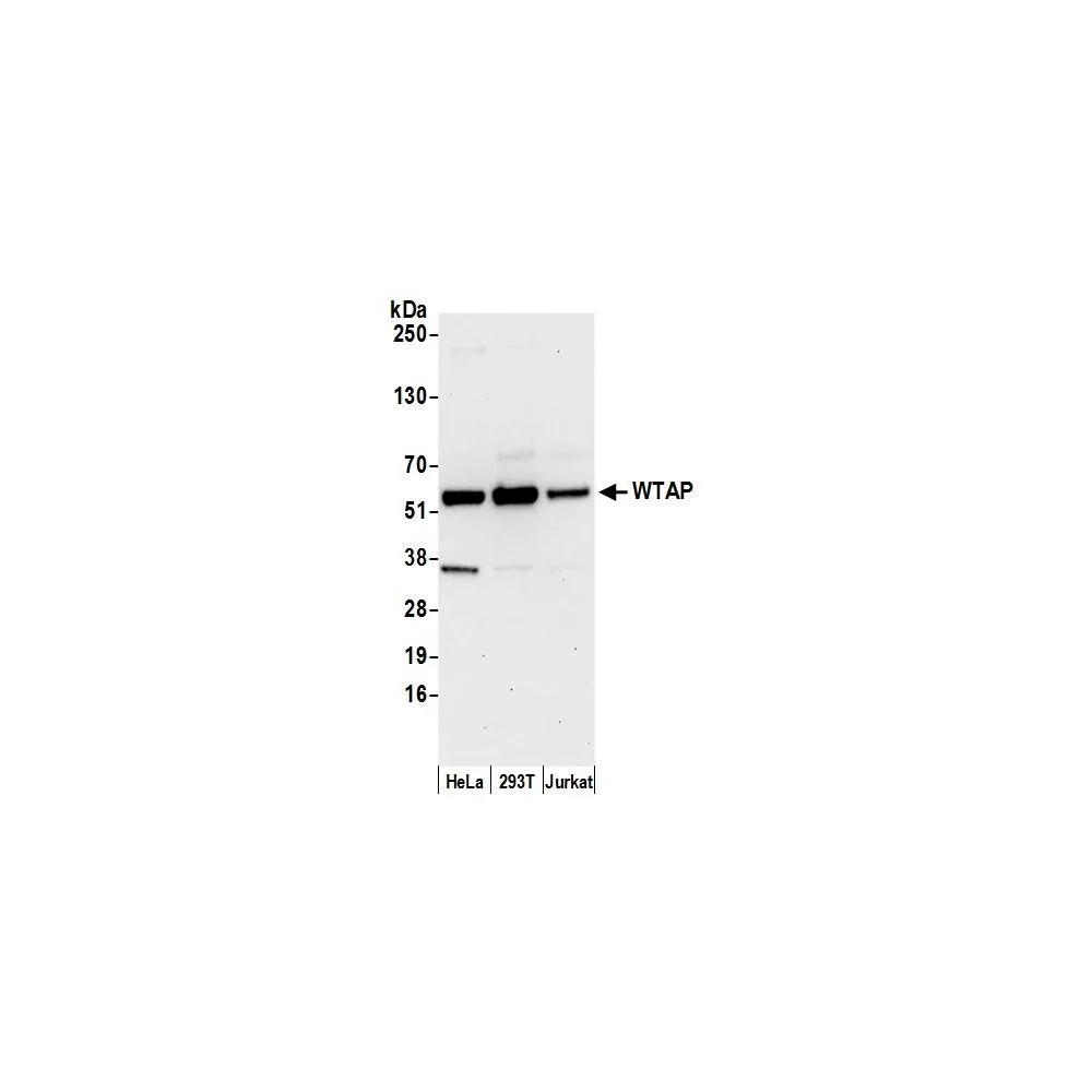 Rabbit anti-WTAP Antibody, Affinity Purified