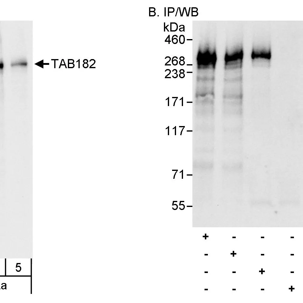 Rabbit anti-TAB182 Antibody, Affinity Purified
