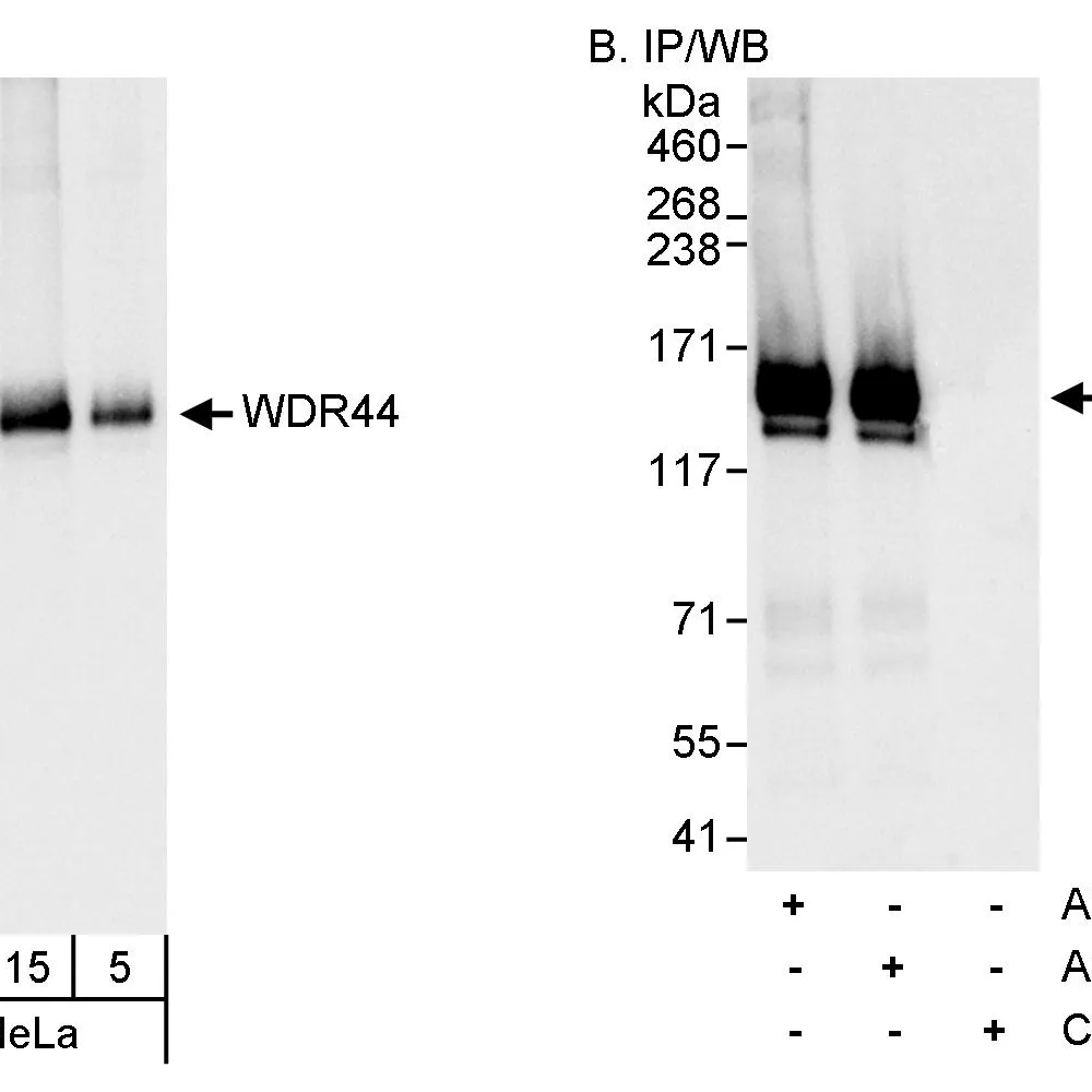 Rabbit anti-WDR44 Antibody, Affinity Purified