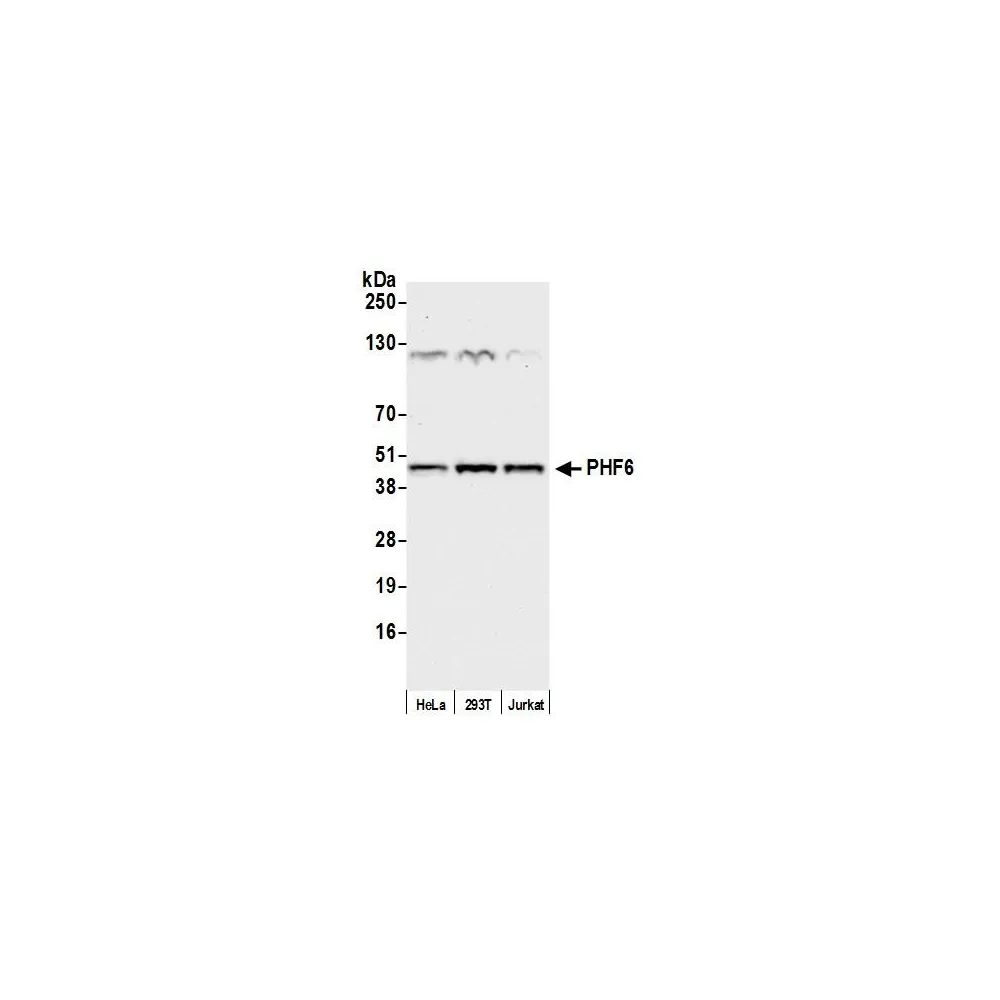 Rabbit anti-PHF6 Antibody, Affinity Purified