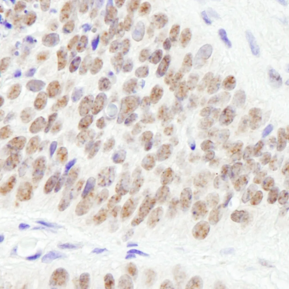 Rabbit anti-PHF6 Antibody, Affinity Purified