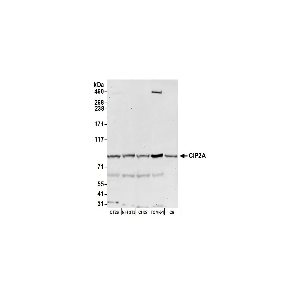 Rabbit anti-CIP2A Antibody, Affinity Purified