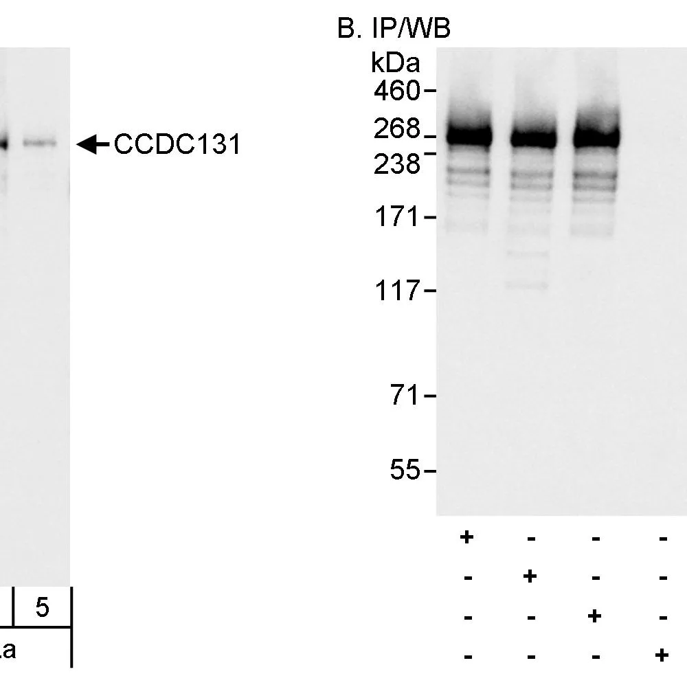 Rabbit anti-CCDC131 Antibody, Affinity Purified