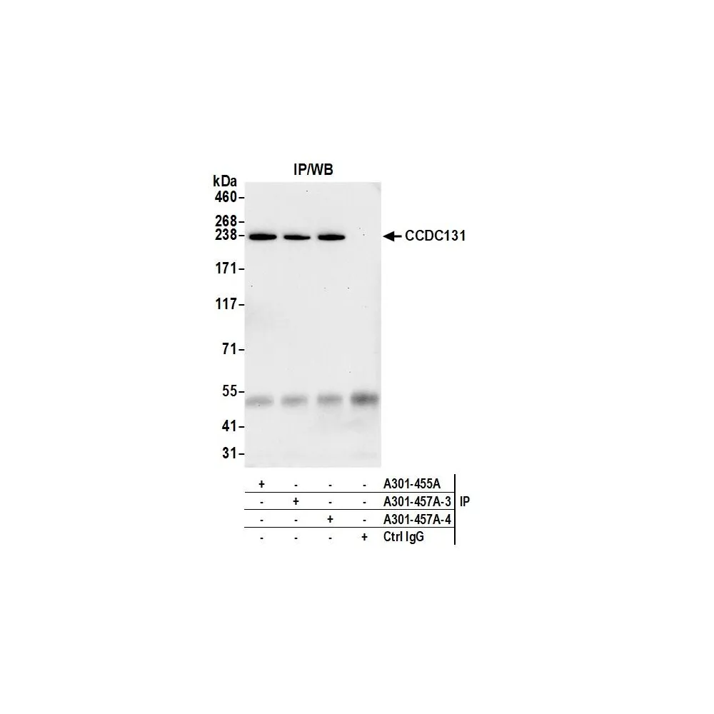 Rabbit anti-CCDC131 Antibody, Affinity Purified