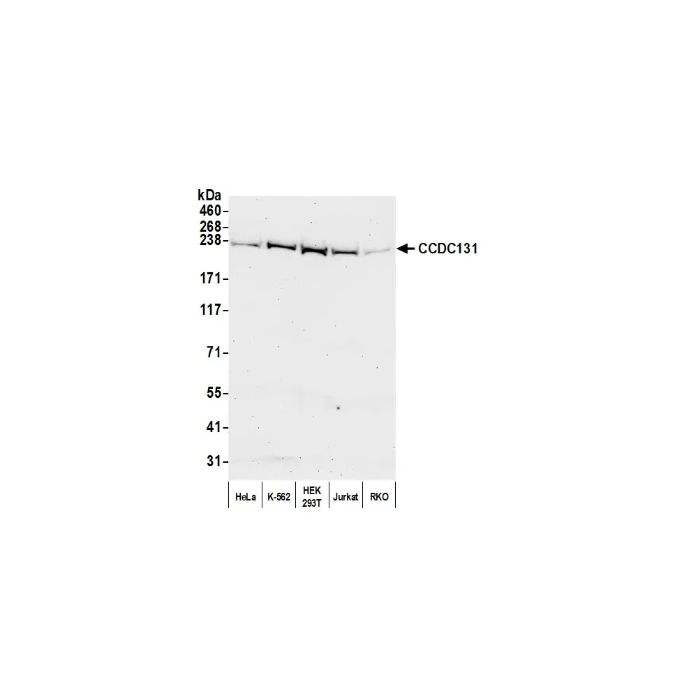 Rabbit anti-CCDC131 Antibody, Affinity Purified