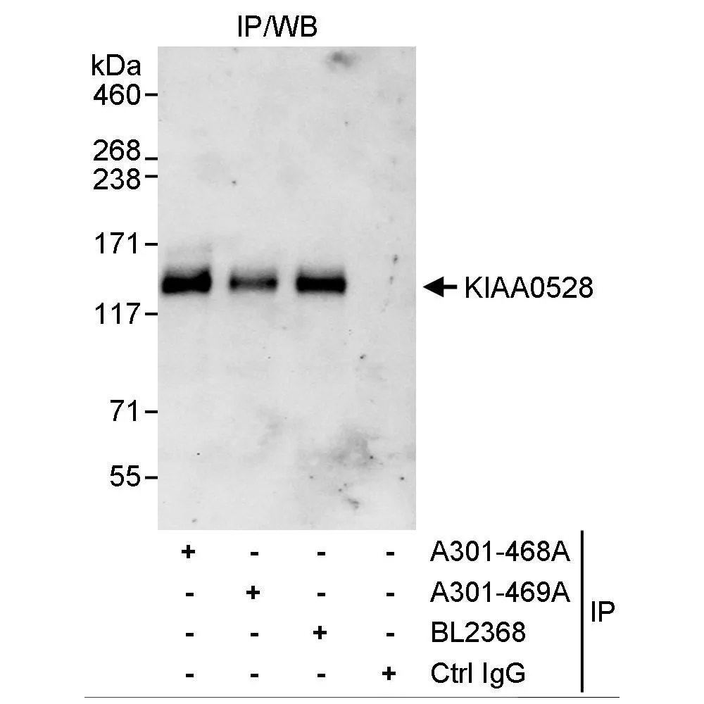 Rabbit anti-KIAA0528 Antibody, Affinity Purified