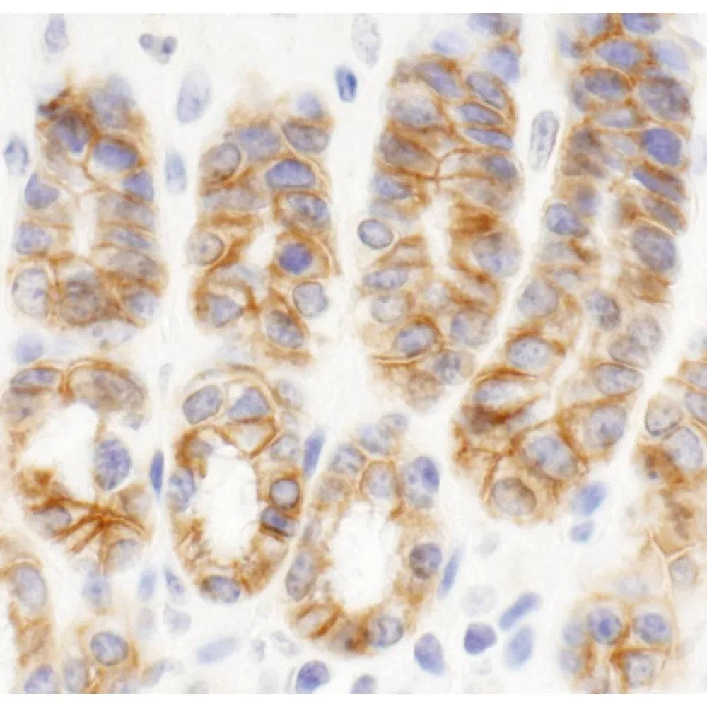 Rabbit anti-KIAA0528 Antibody, Affinity Purified