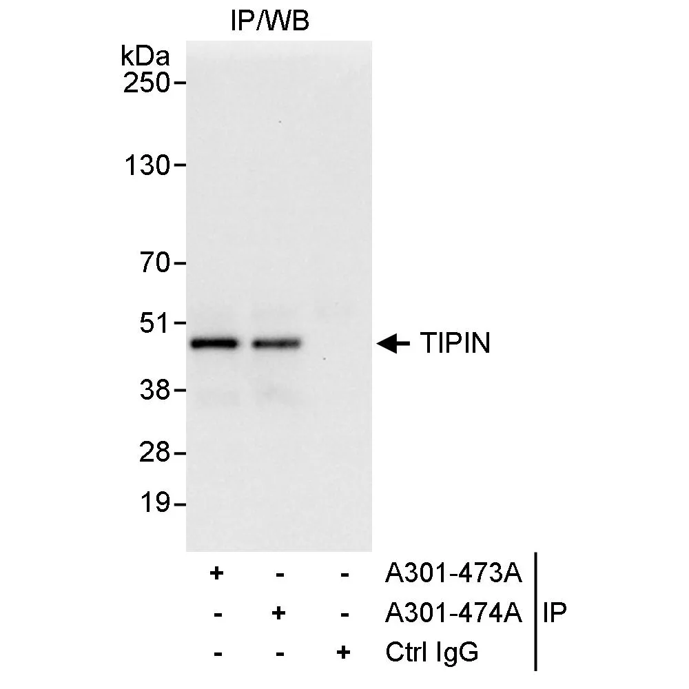 Rabbit anti-TIPIN Antibody, Affinity Purified