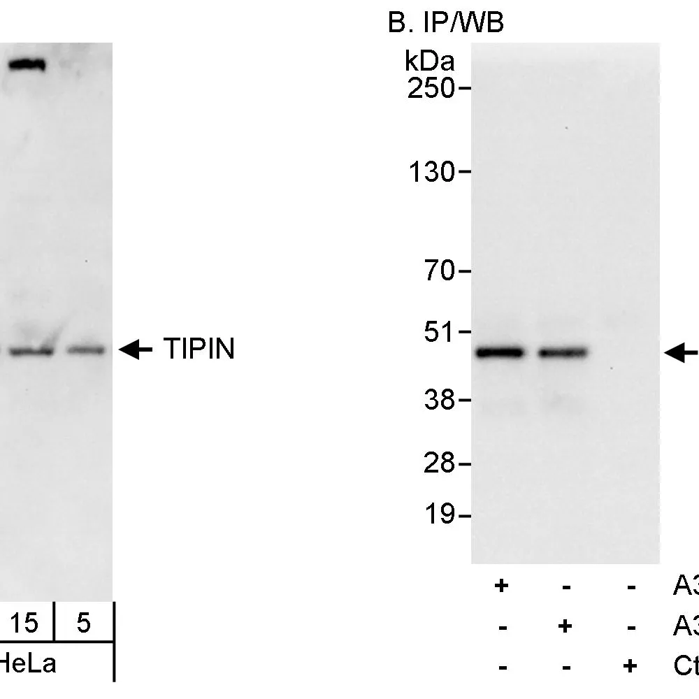 Rabbit anti-TIPIN Antibody, Affinity Purified