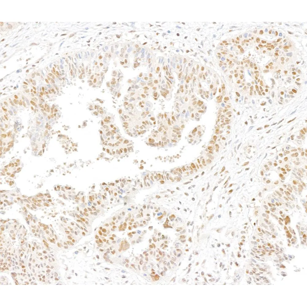 Rabbit anti-ERCC5/XPG Antibody, Affinity Purified