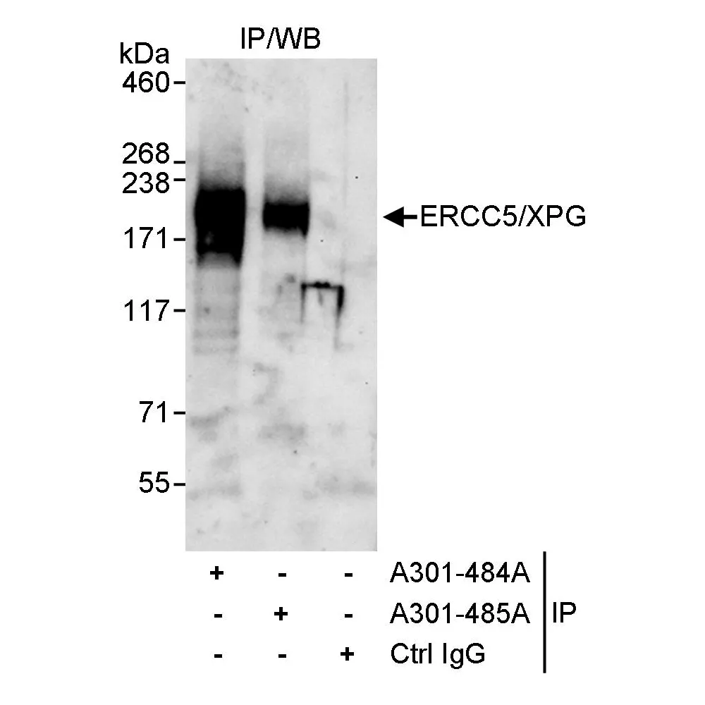 Rabbit anti-ERCC5/XPG Antibody, Affinity Purified