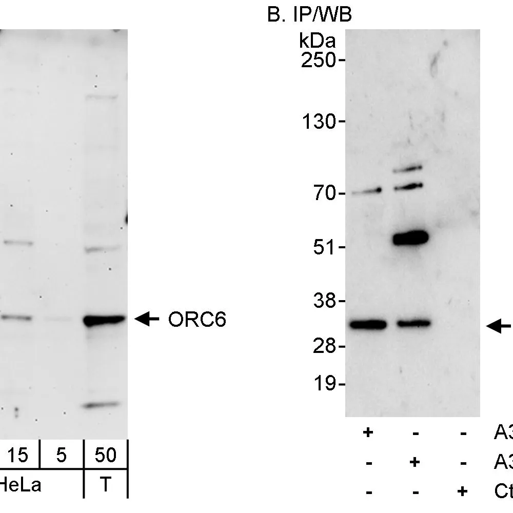 Rabbit anti-ORC6 Antibody, Affinity Purified