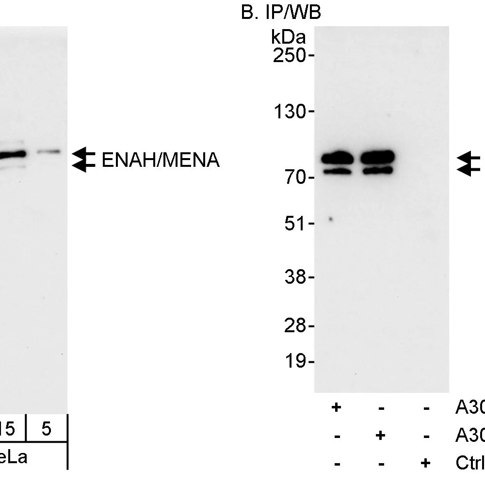 Rabbit anti-ENAH/MENA Antibody, Affinity Purified