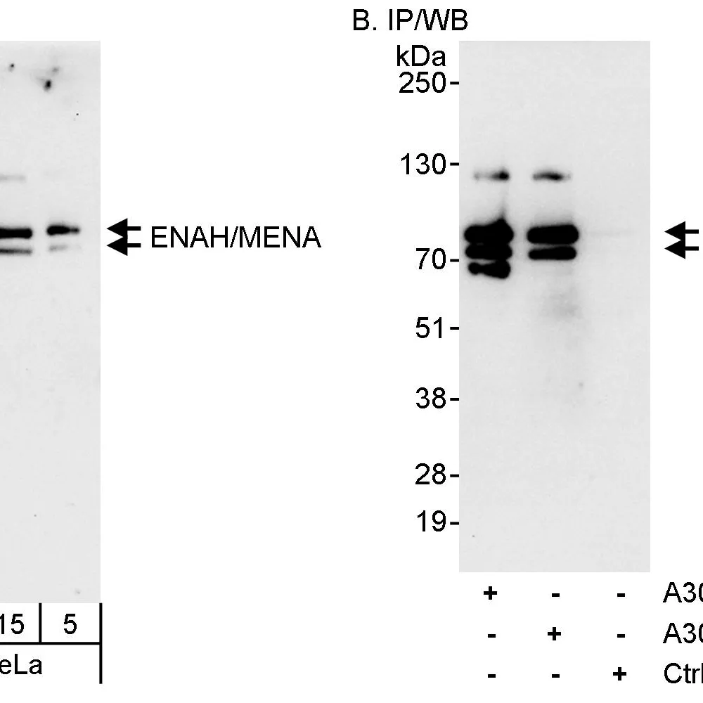 Rabbit anti-ENAH/MENA Antibody, Affinity Purified