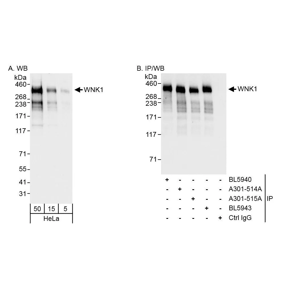 Rabbit anti-WNK1 Antibody, Affinity Purified